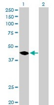 Anti-MAGEA11 antibody produced in rabbit purified immunoglobulin, buffered aqueous solution