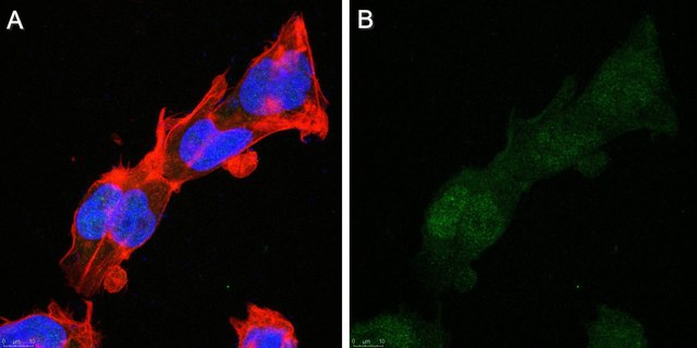 Anti-REST Antibody, clone 12C11