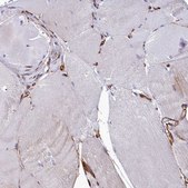 Anti-TNKS1BP1 antibody produced in rabbit Prestige Antibodies® Powered by Atlas Antibodies, affinity isolated antibody, buffered aqueous glycerol solution