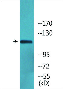 抗 磷酸化-Ret (pTyr 1062 ) 兔抗 affinity isolated antibody