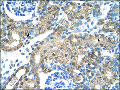 Anti-CHRNB2 antibody produced in rabbit IgG fraction of antiserum