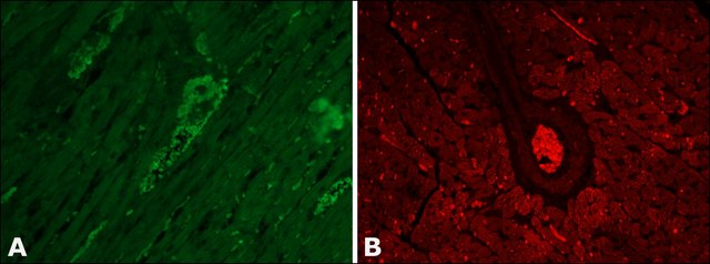 Anti-Vinculin antibody produced in rabbit affinity isolated antibody, buffered aqueous solution