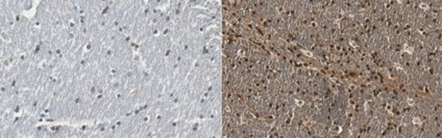 Anti-Huntingtin from rabbit, purified by affinity chromatography