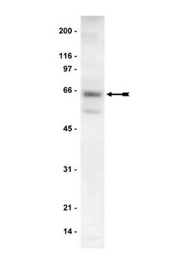 Anti-p70 S6 Kinase (S6K) Antibody Upstate&#174;, from rabbit