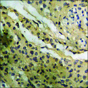 Anti-phospho-GR (pSer226) antibody produced in rabbit affinity isolated antibody