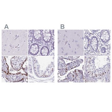 Anti-MORC4 antibody produced in rabbit Prestige Antibodies&#174; Powered by Atlas Antibodies, affinity isolated antibody, buffered aqueous glycerol solution