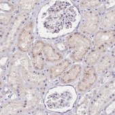 Anti-MAN1C1 antibody produced in rabbit Prestige Antibodies® Powered by Atlas Antibodies, affinity isolated antibody, buffered aqueous glycerol solution