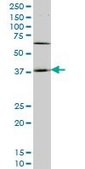 Monoclonal Anti-HOXD11 antibody produced in mouse clone 5E7, purified immunoglobulin, buffered aqueous solution