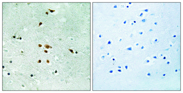 Anti-phospho-FER (pTyr402) antibody produced in rabbit affinity isolated antibody