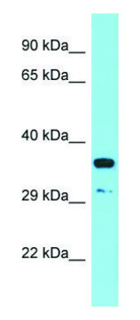 Anti-RSPO3 (C-terminal) antibody produced in rabbit affinity isolated antibody