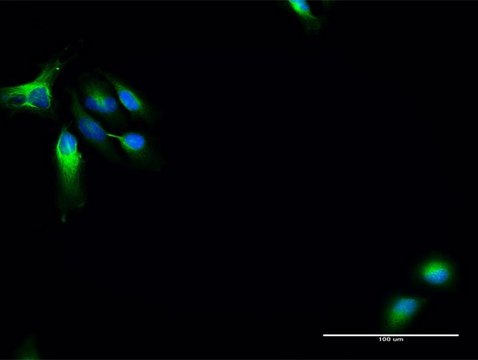 Anti-MAP7 antibody produced in rabbit purified immunoglobulin, buffered aqueous solution