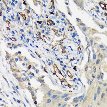 Anti-CD146/MCAM antibody produced in rabbit