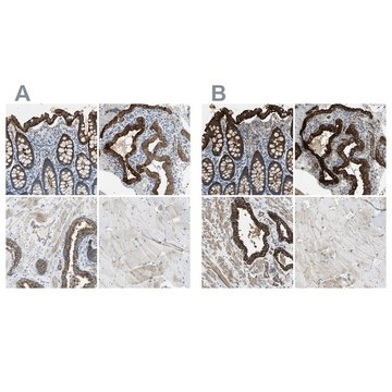 Anti-FLNB antibody produced in rabbit Prestige Antibodies&#174; Powered by Atlas Antibodies, affinity isolated antibody, buffered aqueous glycerol solution