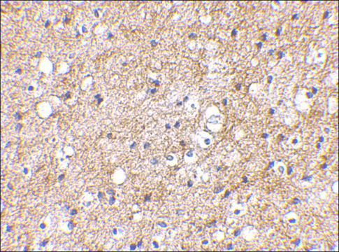 Anti-IPR1 (ab1) antibody produced in rabbit affinity isolated antibody, buffered aqueous solution