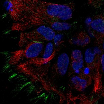 Anti-STOML3 antibody produced in rabbit Prestige Antibodies&#174; Powered by Atlas Antibodies, affinity isolated antibody, buffered aqueous glycerol solution