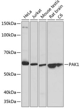 Anti-PAK1 Antibody, clone 6R3M5, Rabbit Monoclonal