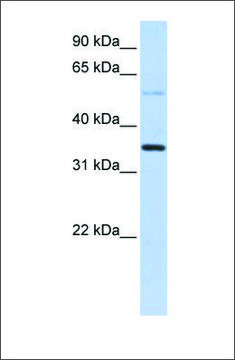 Anti-ANKRD9 antibody produced in rabbit affinity isolated antibody