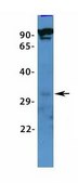 Anti-VDAC3, (N-terminal) antibody produced in rabbit affinity isolated antibody