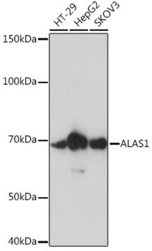 Anti-ALAS1 Antibody, clone 2K1G3, Rabbit Monoclonal