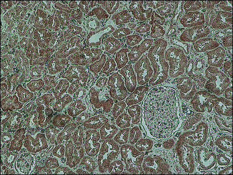 Anti-Copeptin antibody produced in rabbit affinity isolated antibody