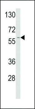 ANTI-TPA (CENTER) antibody produced in rabbit purified immunoglobulin, buffered aqueous solution