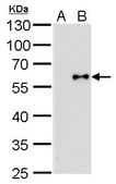 Monoclonal Anti-Influenza B Virus NP antibody produced in mouse clone GT371, affinity isolated antibody