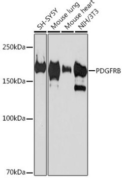 Anti-PDGFRB Antibody, clone 6E8C10, Rabbit Monoclonal