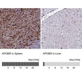 Anti-APOBR antibody produced in rabbit Prestige Antibodies® Powered by Atlas Antibodies, affinity isolated antibody, buffered aqueous glycerol solution