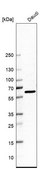 Anti-ELP3 antibody produced in rabbit Prestige Antibodies® Powered by Atlas Antibodies, affinity isolated antibody, buffered aqueous glycerol solution