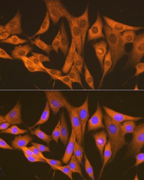 Anti-ASS1 Antibody, clone 4W1M8, Rabbit Monoclonal