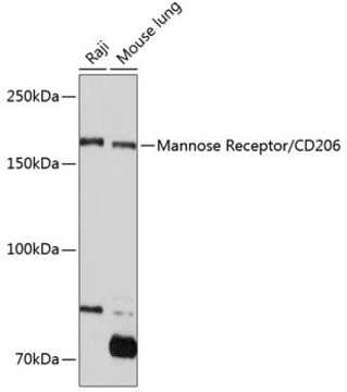 Anti-Mannose Receptor/CD206 antibody produced in rabbit