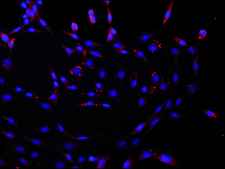 Anti-DCP2 (C-terminal) antibody produced in rabbit ~1 mg/mL, affinity isolated antibody, buffered aqueous solution