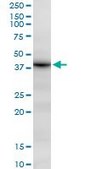 Anti-DHRS7 antibody produced in mouse IgG fraction of antiserum, buffered aqueous solution