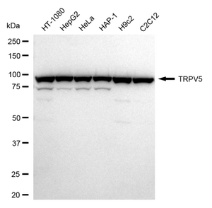 Anti TRPV5 Antibody, clone 24GB1850, Rabbit Monoclonal clone 24GB1850, recombinant rabbit monoclonal, expressed in HEK293 cells