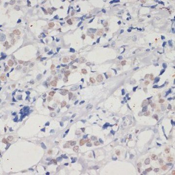 Anti-DNMT1 antibody produced in rabbit