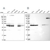 Anti-SUCLA2 antibody produced in rabbit Prestige Antibodies® Powered by Atlas Antibodies, affinity isolated antibody, buffered aqueous glycerol solution