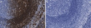 Anti-p-ZAP-70 (Tyr319) Antibody, clone 1B10 ZooMAb® Rabbit Monoclonal recombinant, expressed in HEK 293 cells