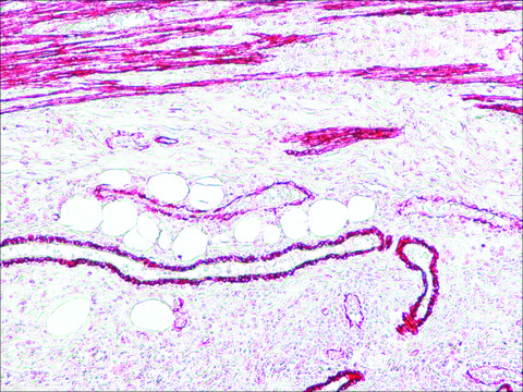 Anti-Mouse IgG (Fc specific)–Alkaline Phosphatase antibody produced in goat affinity isolated antibody, buffered aqueous solution