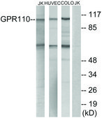 Anti-GPR110 antibody produced in rabbit affinity isolated antibody