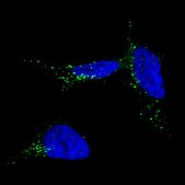 Monoclonal Anti-TYRP1 antibody produced in mouse Prestige Antibodies® Powered by Atlas Antibodies, clone CL4906, purified immunoglobulin, buffered aqueous glycerol solution
