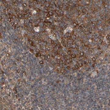 Anti-RIOK2 antibody produced in rabbit Prestige Antibodies&#174; Powered by Atlas Antibodies, affinity isolated antibody, buffered aqueous glycerol solution