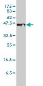 Monoclonal Anti-STEAP1 antibody produced in mouse clone 4F6-1F3, ascites fluid