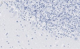 Anti-S100-B Antibody, clone 8F20 ZooMAb® Rabbit Monoclonal recombinant, expressed in HEK 293 cells