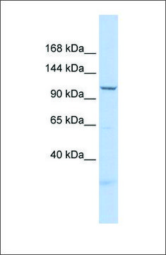 Anti-SKIV2L2 antibody produced in rabbit affinity isolated antibody