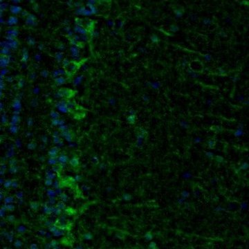 Anti-ECH1 antibody produced in rabbit Prestige Antibodies&#174; Powered by Atlas Antibodies, affinity isolated antibody, buffered aqueous glycerol solution