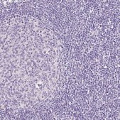 Anti-TMEM213 antibody produced in rabbit Prestige Antibodies® Powered by Atlas Antibodies, affinity isolated antibody, buffered aqueous glycerol solution