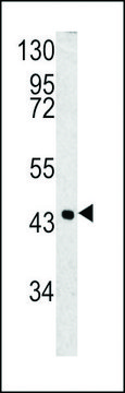 ANTI-SPB3(N-TERMINAL) antibody produced in rabbit purified immunoglobulin, buffered aqueous solution