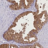 Anti-DCAF16 antibody produced in rabbit Prestige Antibodies® Powered by Atlas Antibodies, affinity isolated antibody, buffered aqueous glycerol solution