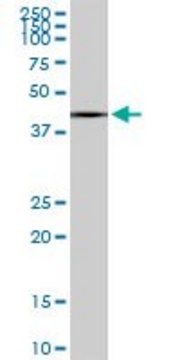 Monoclonal Anti-SLC25A16 antibody produced in mouse clone 1H7, purified immunoglobulin, buffered aqueous solution