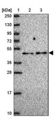Anti-TRMT10A antibody produced in rabbit Prestige Antibodies® Powered by Atlas Antibodies, affinity isolated antibody, buffered aqueous glycerol solution